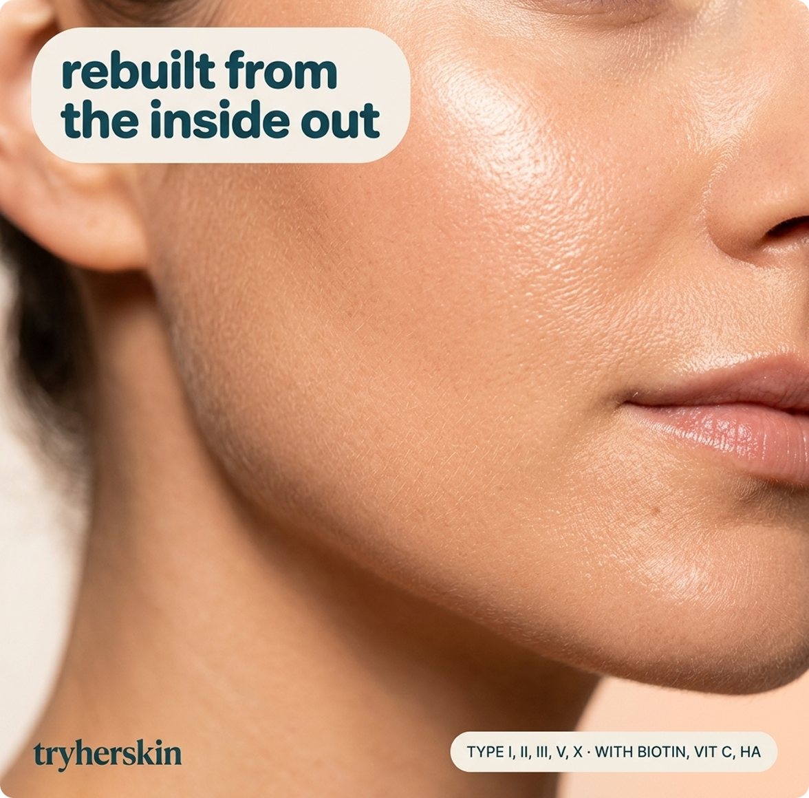 1. IT Rebuilds Skin From Within